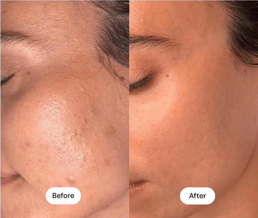 EMS Microcurrent Device – The 5-Minute Face & Neck Lift Routine